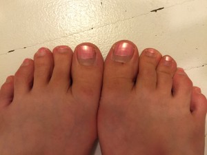 My half grown out pedicure